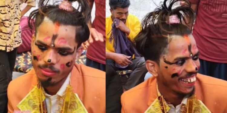 Viral Video: बच्चों की तरह सजाया गया दूल्हा, मुस्कुराहट पर दिखी ऐसी चीज देखकर डर गए लोग