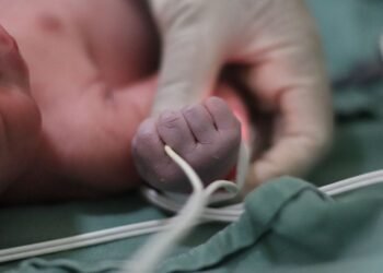 कुदरत का करिश्मा! 2 इंच लंबी पूंछ के साथ जन्मी बच्ची, देखकर डॉक्टर भी रह गए हैरान
